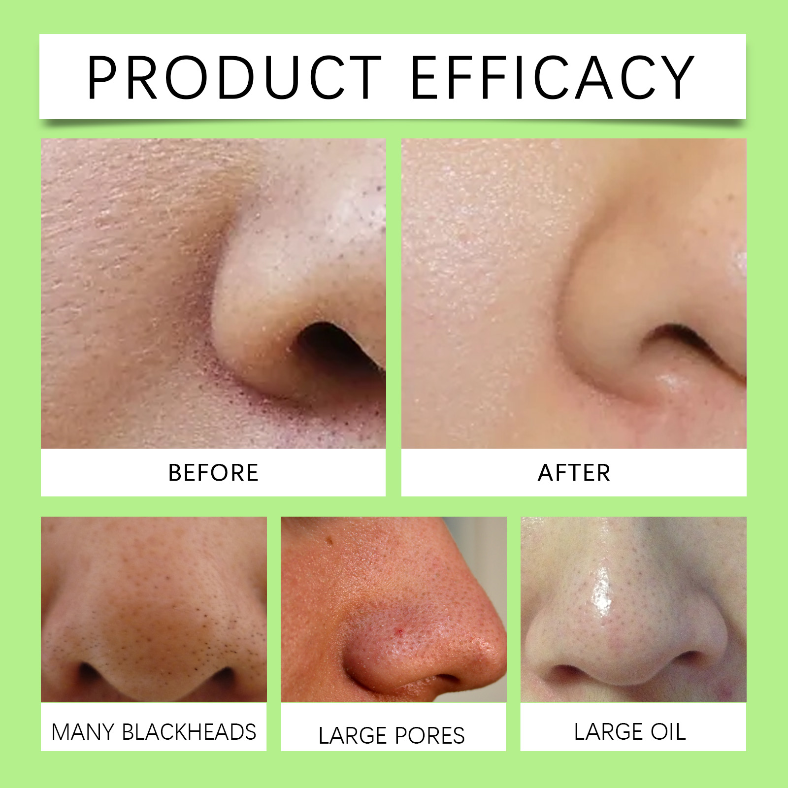 竹炭ノーズストリップ（黒ずみ用）72枚＋無料30mlコラーゲ - Skincare Collagen のレビューと価格
