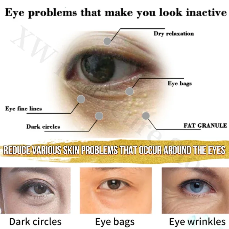 スネークヴェノムアイクリーム、鮮やかなドライストリアル、バッ - Eye Cream Peptide のレビューと価格